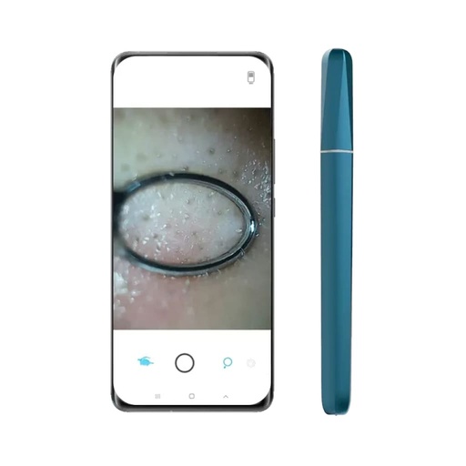 [URUN0953] Wisdom Smart Pore Cleaner with Camera
